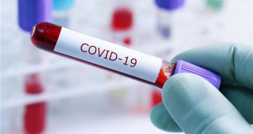 Dünyada koronavirusla bağlı son STATİSTİKA