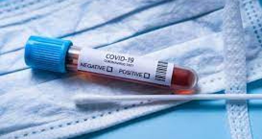 Dünyada son yeddi gündə 8,7 min insan COVID-19 səbəbilə ölüb