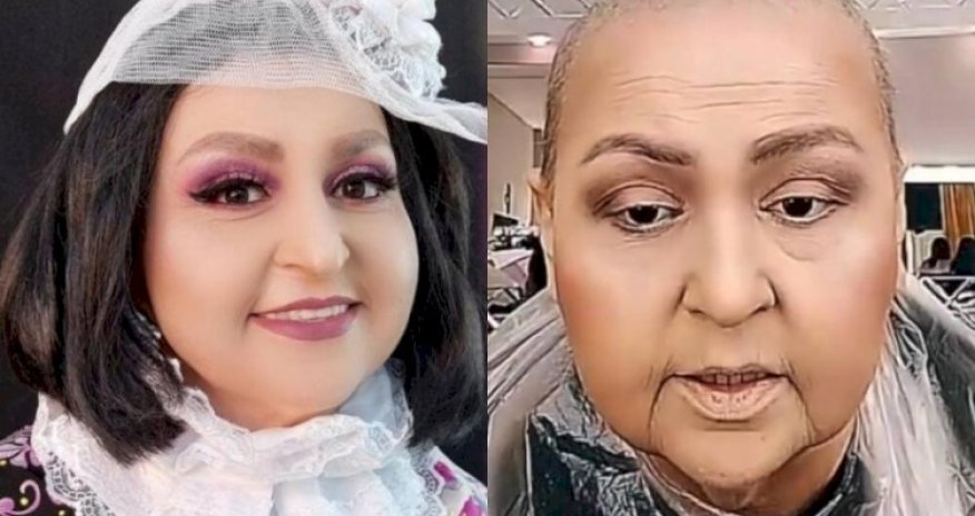 Xərçəng bütün bədənimə yayılıb - “Toppuş bacı”