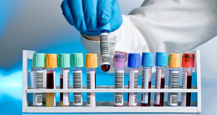 Koronavirusla bağlı dünyada son vəziyyət 