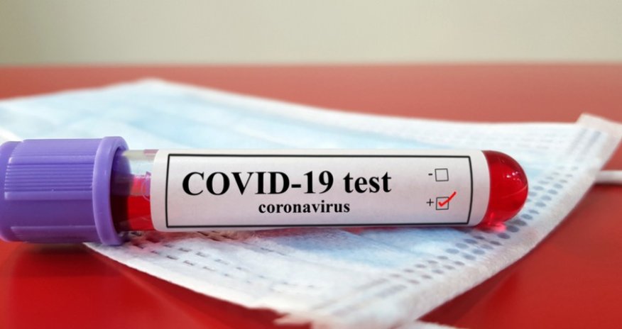 Azerbaijan reports 305 new COVID cases, 2 deaths