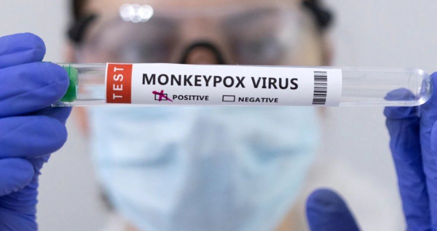 Niderlandda meymunçiçəyinə qarşı vaksinasiya başlayıb