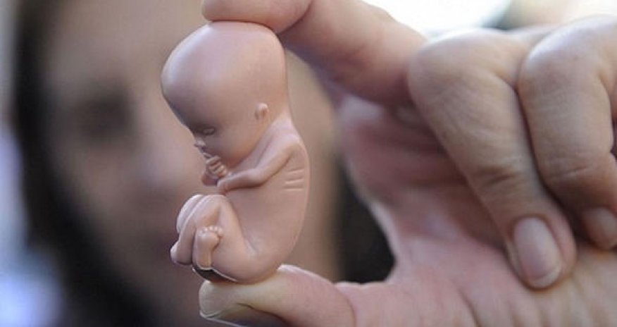 ABŞ-ın bu ştatında abort qadağan edildi