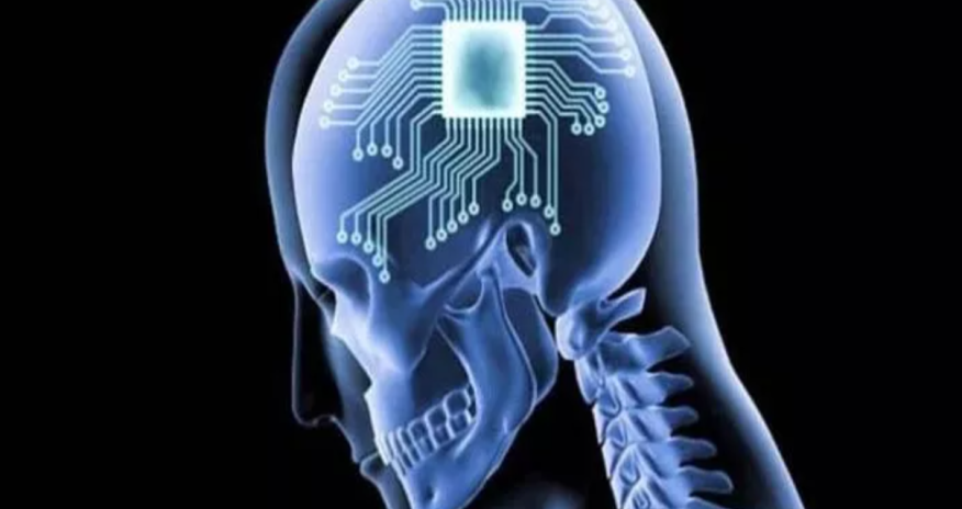 Planetdəki bütün insanların başına xüsusi çip taxmaq lazımdır - Elon Mask