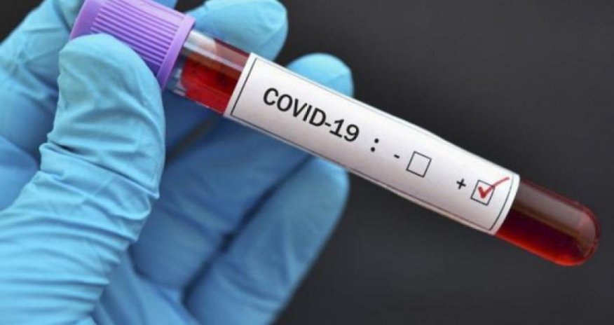 Son sutkada Azərbaycanda koronavirusa yoluxanların sayı AÇIQLANDI