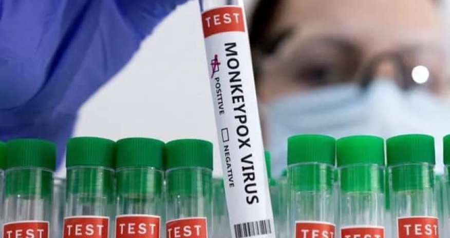 Rusiya meymunçiçəyinə qarşı vaksin hazırladı