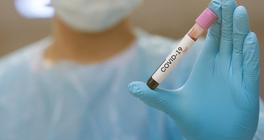 Azerbaijan confirms 325 new COVID-19 cases, 7 deaths