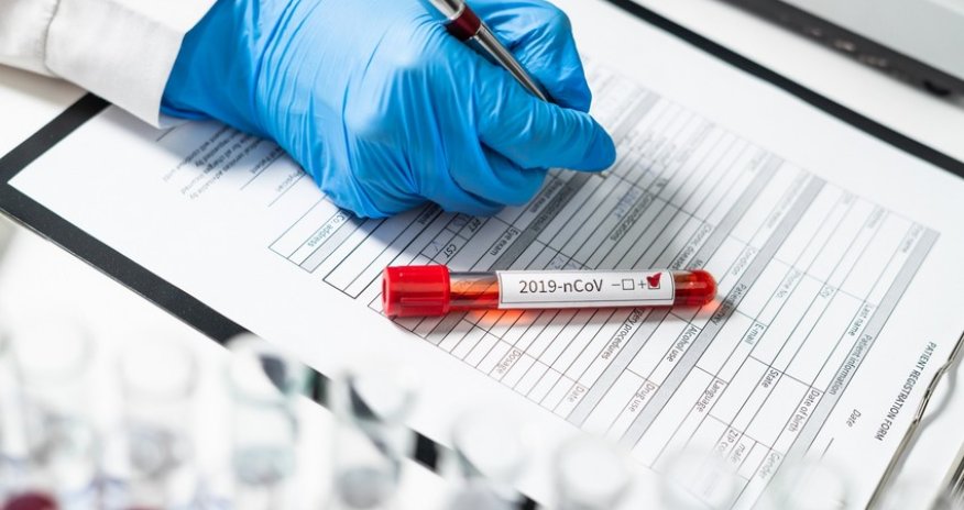 Azerbaijan records 259 new COVID cases