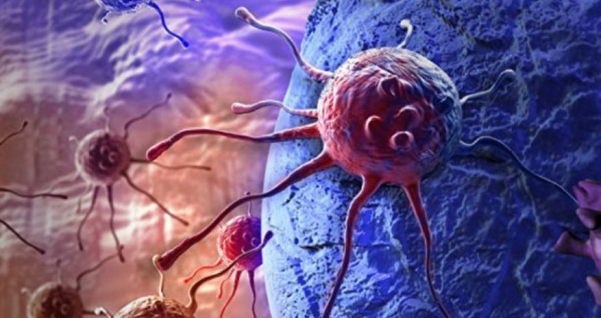 Xərçəng xəstəliyini sağaldan gel hazırlandı