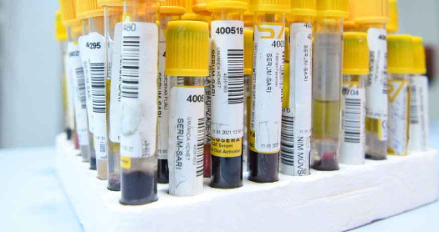 Статистика по COVID в Азербайджане