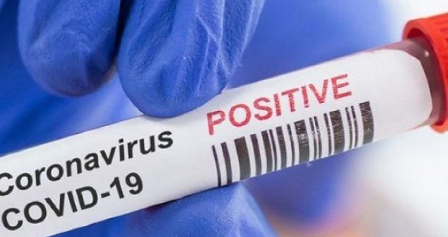 COVID в Азербайджане: рост заболевших