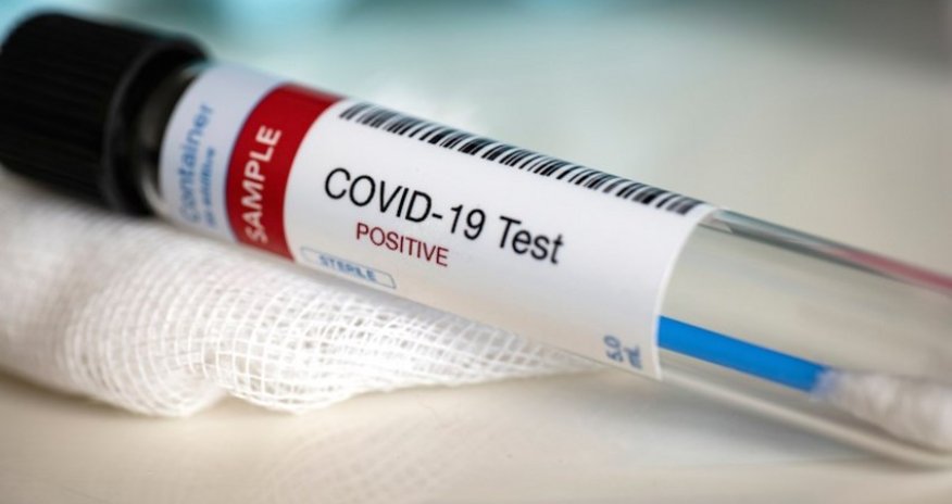 Azerbaijan confirms 41 new COVID-19 cases