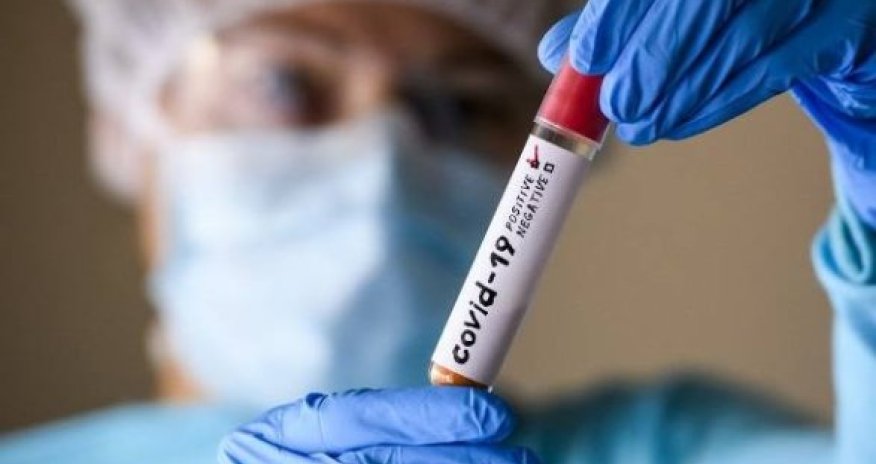 В США рассказали, откуда взялся коронавирус