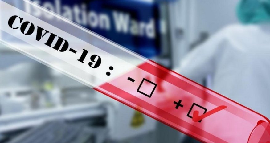 Dünyada koronavirusa yoluxanların sayı 641 milyonu ötüb