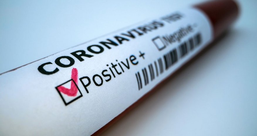 Azerbaijan reports 62 new coronavirus cases