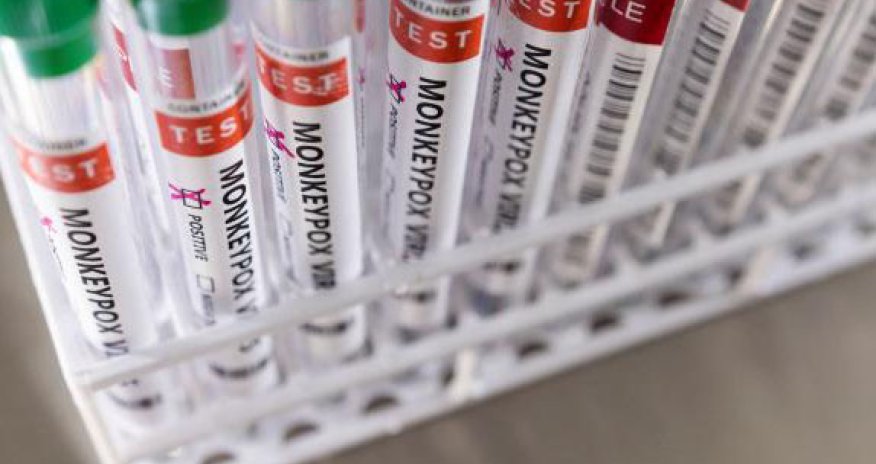 Şimali Kiprdə meymunçiçəyi aşkarlandıb