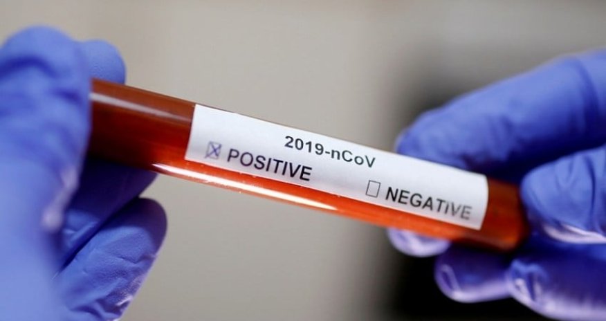 Azerbaijan confirms 84 new COVID-19 cases