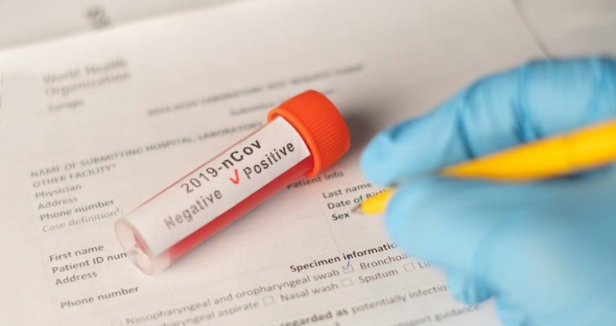 Azerbaijan reports 62 new COVID-19 cases