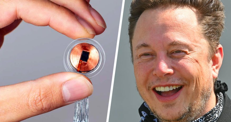 Mask insanlar üzərində beyin çipini test etmək istəyir - ABŞ icazə vermir 