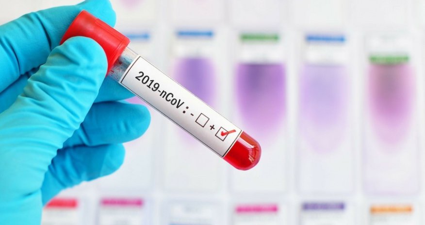 Azerbaijan confirms 69 new COVID-19 cases, 4 deaths