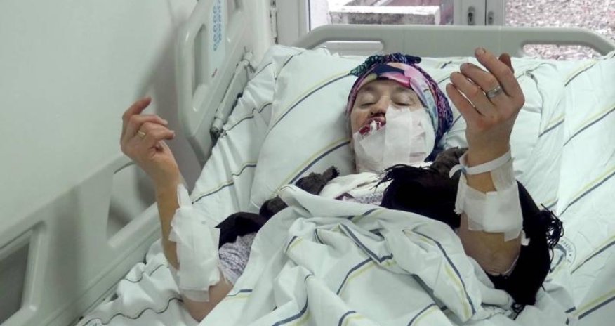 Canavar kəndə gəldi - 4 nəfəri dişlədi