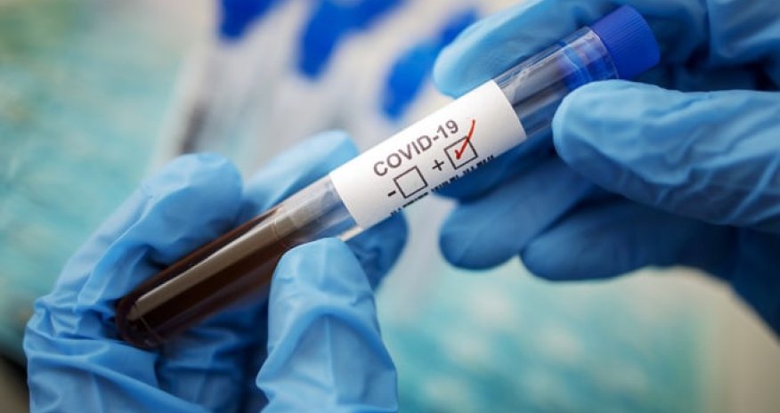 Azərbaycanda  13 nəfər COVID-19-a yoluxub, 1 nəfər vəfat edib