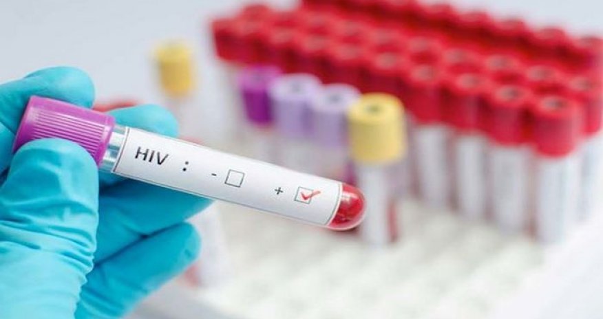 Qanada ötən il 9 mindən çox insan QİÇS-dən ölüb