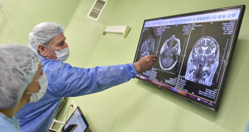 Alimlərin covidin insan beynini 20 ilə qədər geri saldığını araşdırıb