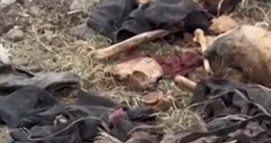 Xocalıda əl-ayağı bağlı skelet qalıqları aşkarlanıb - VİDEO
