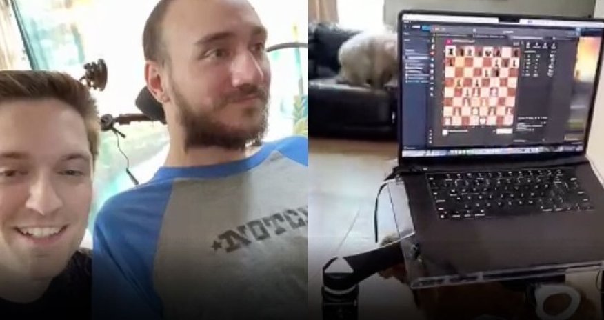 Beyninə çip yerləşdirilən ilk pasiyent şahmat oynayıb - Video