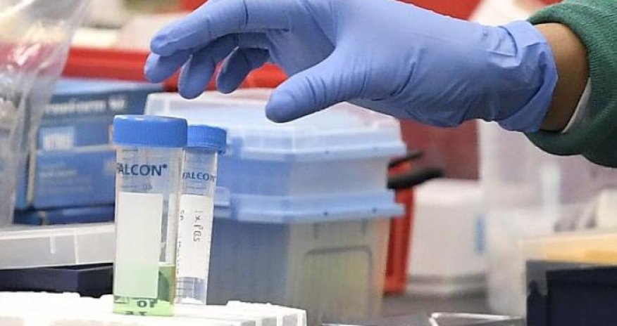 Niderlandda 613 gündür koronavirusa yoluxmuş şəxs vəfat edib