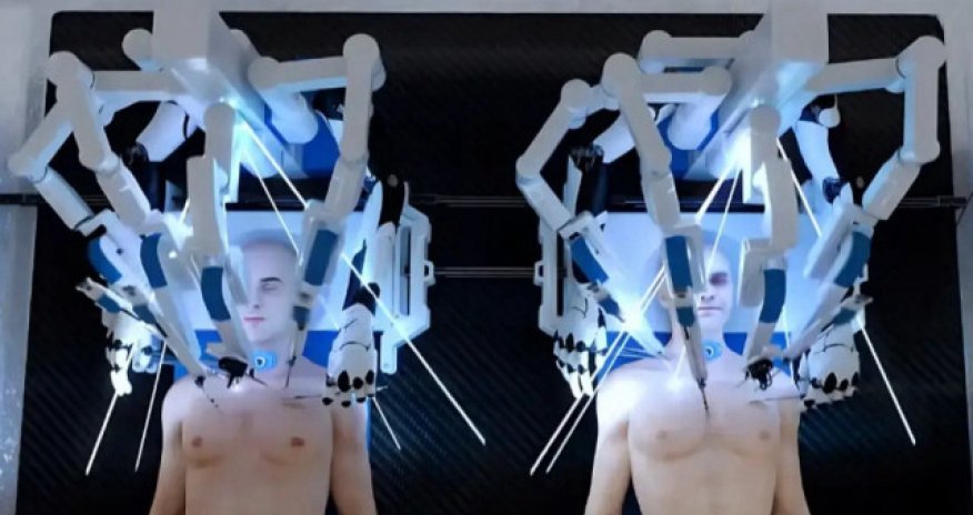 Baş transplantasiyası əməliyyatında süni intellektdən istifadə olunacaq-VİDEO