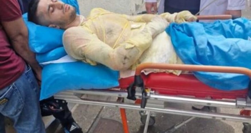 Qız qaçıran qazi özünü yandırıb