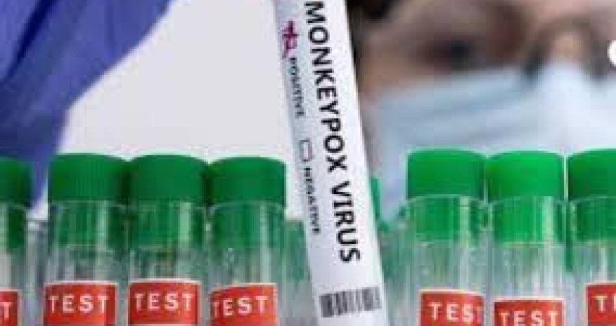 ÜST meymunçiçəyi virusuna qarşı ilk peyvəndi təsdiqləyib