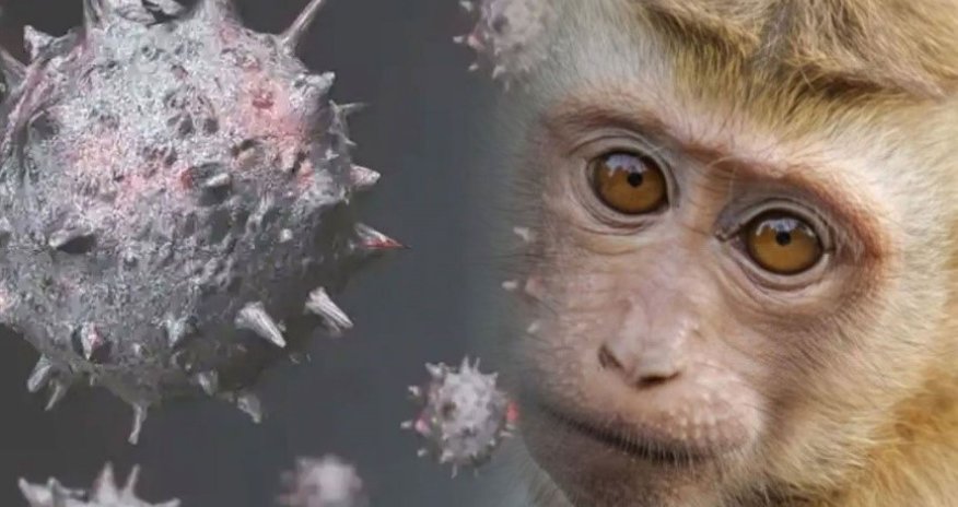 Meymunçiçəyinə yoluxmuş 100-dən çox pasient xəstəxanadan qaçıb - KİV