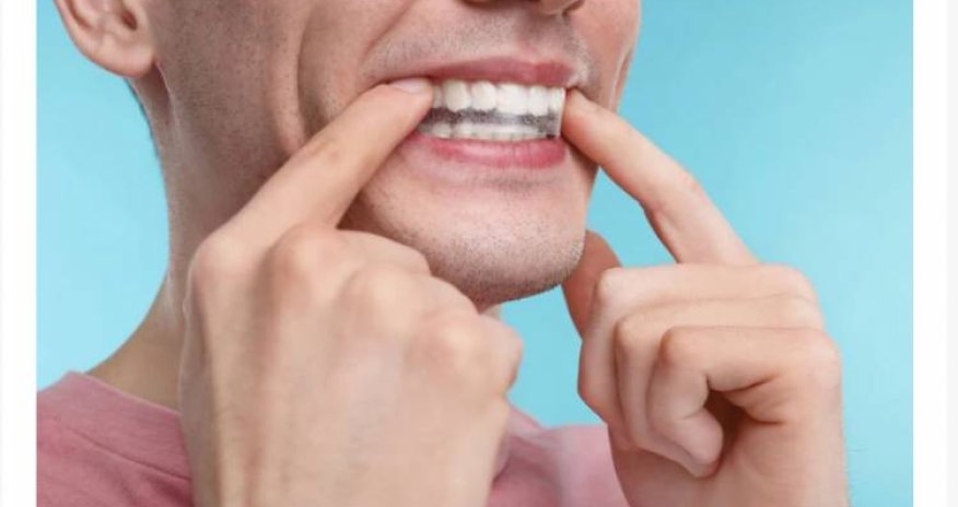 Alimlərin araşdırması deyir ki, implant 40 il insana xidmət edə bilər