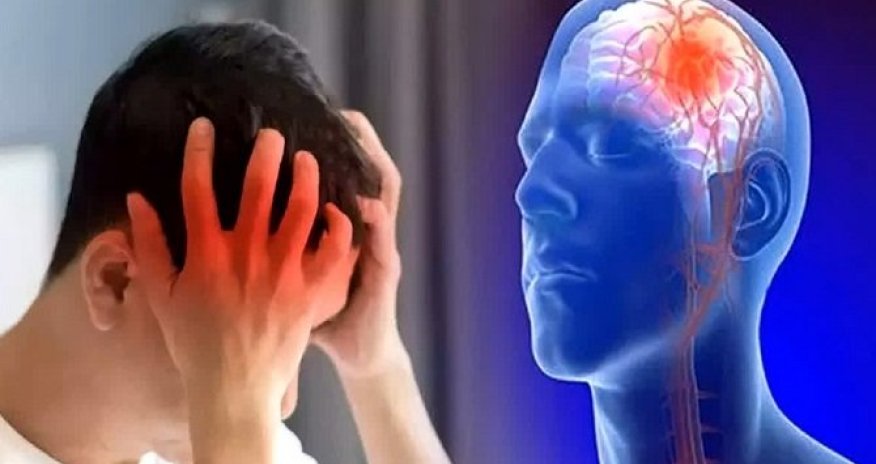 İnsultdan sonra hərəkəti tam bərpa etmək mümkün olacaq