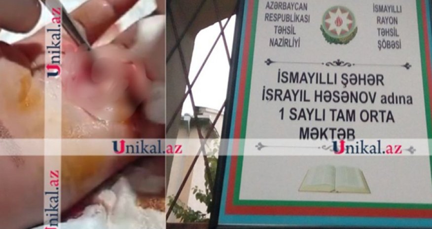 Şagird sinif yoldaşına stul atıb, müəllim hadisəni gizlədib- Səs yazısı