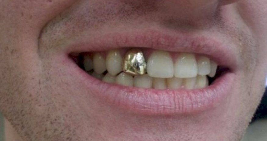 Meyitlərin qızıl dişlərini oğurlamaqda ittiham olunan şəxs saxlanılıb