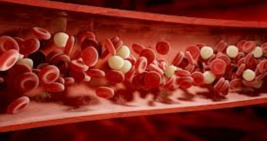 Ölkədə talassemiya diaqnozu ilə doğulan uşaqların sayı açıqlanıb