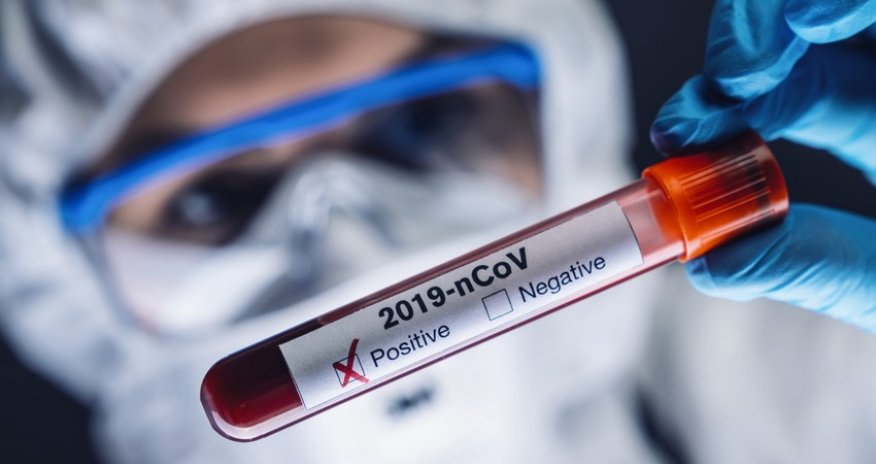 СМИ: В Азии распространяется новая волна COVID-19