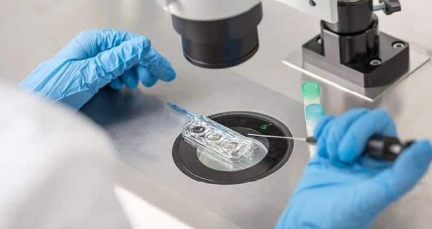 Vəfat edən həmin xanım mətbəxdə əməliyyat olunub - Nazir