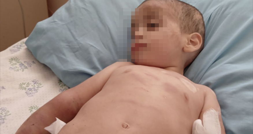 Ağdamda iki yaşlı uşaq döyülüb