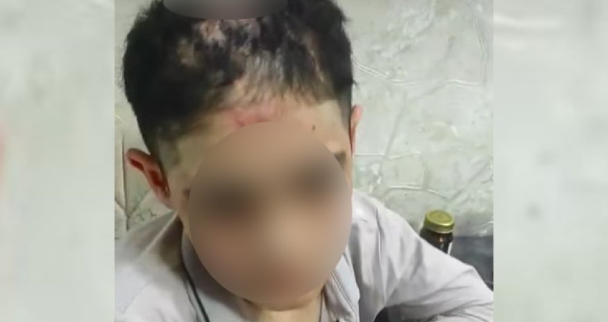 14 yaşlı yeniyetmə zorakılıq iddiaları ilə bağlı səhiyyə müəssisəsinə yerləşdirilib