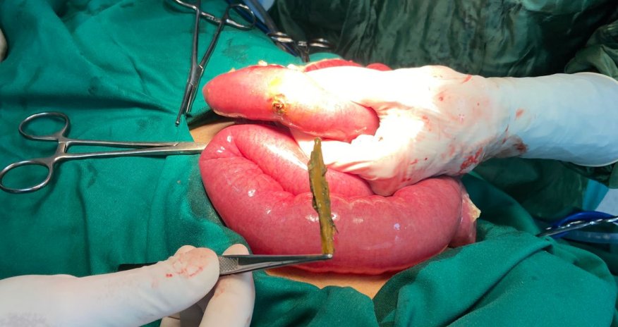 17 yaşlı yeniyetmə taxta udub