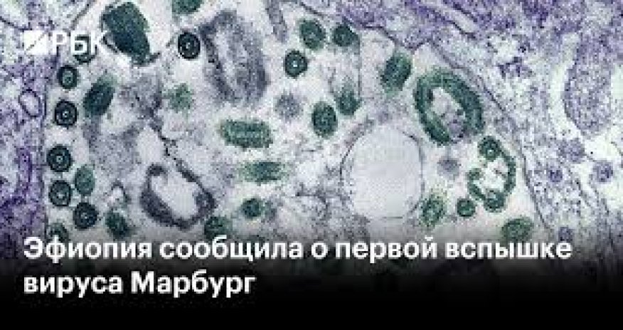 Efiopiyada təhlükəli virusun yayıldığı təsdiqlənib