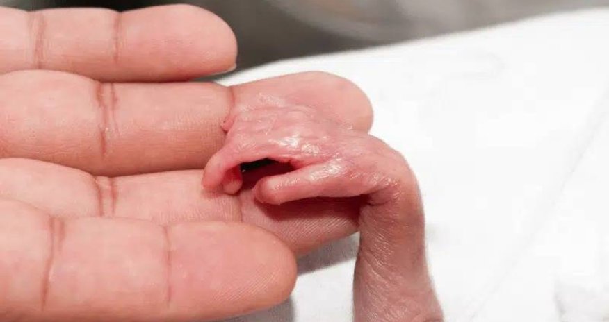 Xəstəxanın ərazisində ağacın altında 34-36 həftəlik ölü döl tapılıb