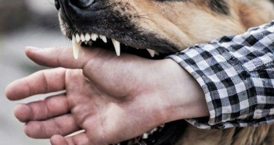 Bakının bu qəsəbəsində 1 ay ərzində 65 nəfəri it dişləyib