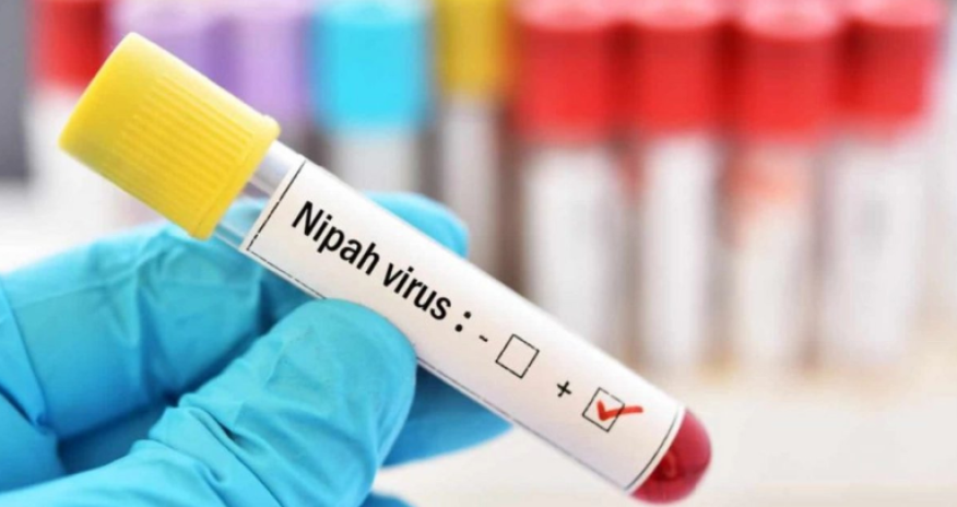 Nipah virus and global exposure: is Azerbaijan immune to the risk?