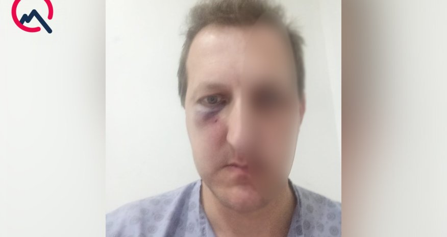 Bakıda Xalq artistinin oğlu döyülüb, bir nəfər saxlanılıb